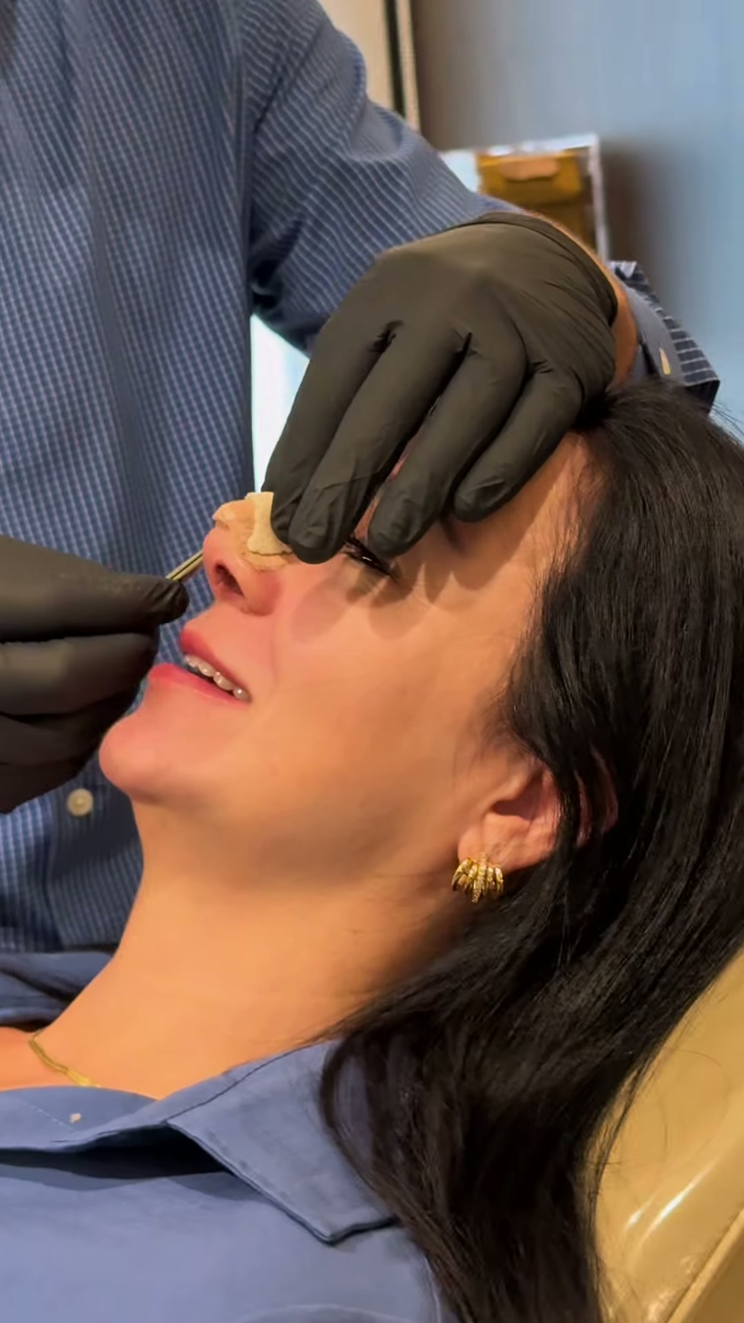 Paciente sorrindo na retirada do curativo após rinoplastia